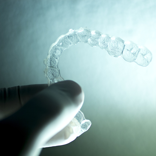 Braces Retention Period Dr. Kershman Ottawa, Canada